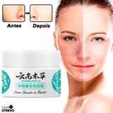 Creme Clareador de Manchas Escuras à Base de Leite - Milk Whitening® (Clareamento 100% Comprovado)