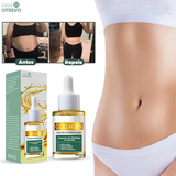 Oléo Puro de Colágeno Redutor de Medida e Celulite - LifitOil 10 em 1® (ELIMINAÇÃO TOTAL DA GORDURA)