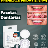 (Nature Smile) - Facetas Dentárias Removíveis