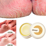 Cera Removedora de Calos e Rachaduras - ®Foot Gold