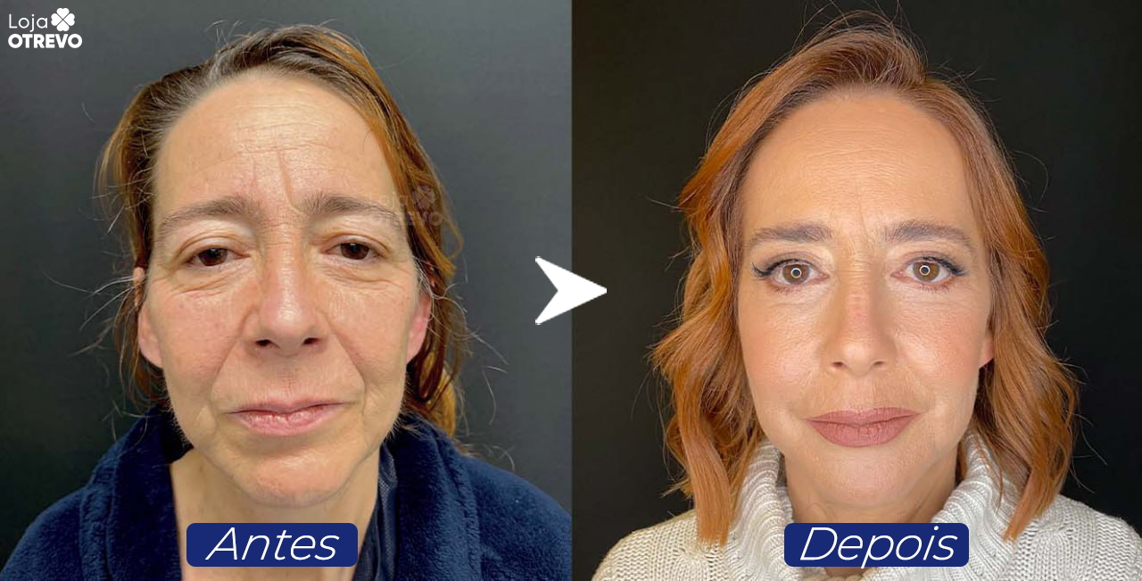 Creme Reparador de Olhos Caidos - LifitEye®