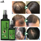 Super Tônico de Crescimento Rápido Capilar (Efeito Rapunzel) 2 em 1  - NutriHair®