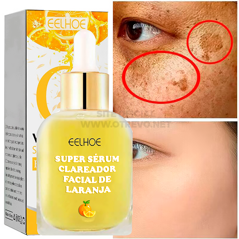 Super Serum Clareador Facial - ®GoldOrange