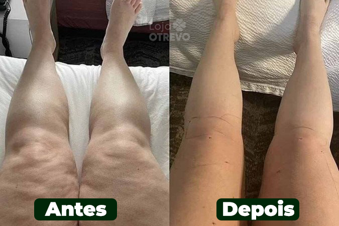 PureCleanse - Chá Natural Anti inflamatório (Redutor de inchaços)