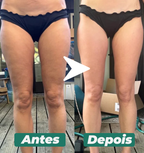 DrenaSkin® 3 em 1  - Massageador Redutor de Celulite e Gorduras Localizadas