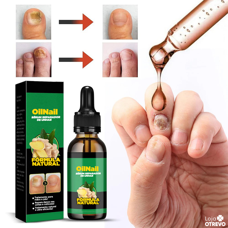 OilNail® - Sérum Reparador Rápido de Unhas (REPARAÇÃO EM 7 DIAS)