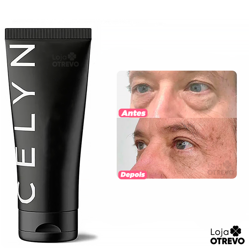 Renew Face CELYN® (Redutor de Olheira, Flacidez e Linha de Expressão)