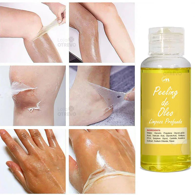 Óleo De Peeling (Clareador e Renovador de Pele) -  Yellow Oil®