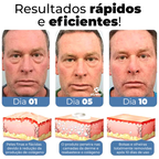 OpenEyes - Creme Reparador Rápido de Olhos (Elimina Rugas, Bolsas e Olheiras)