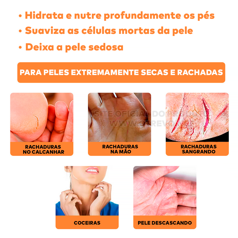 Cera Removedora de Calos e Rachaduras - ®Foot Gold