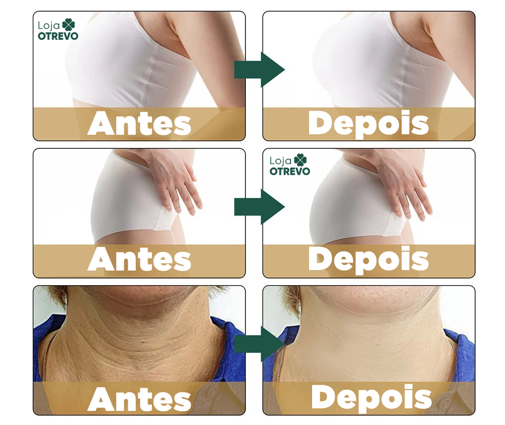 Oléo Puro de Colágeno Redutor de Medida e Celulite - LifitOil 10 em 1® (ELIMINAÇÃO TOTAL DA GORDURA)