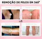 Super Spray Depilatório - BodyPil® (RENDE 100 APLICAÇÕES)