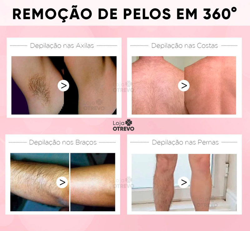 Super Spray Depilatório - BodyPil® (RENDE 100 APLICAÇÕES)