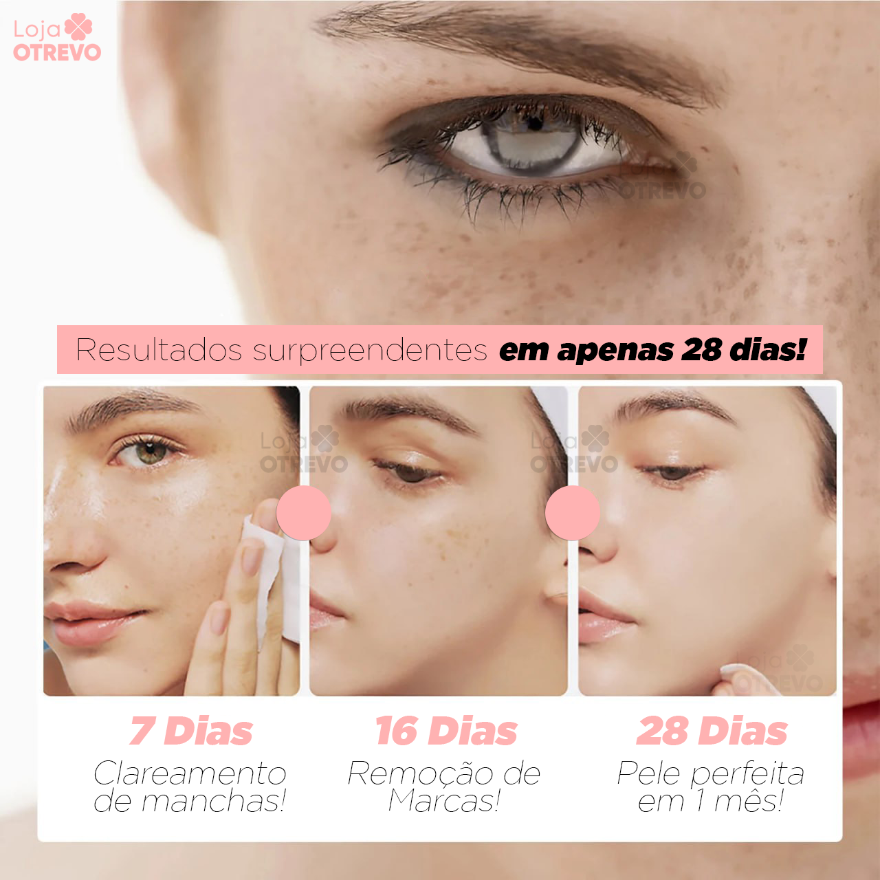 SpotCream® Creme Restaurador Facial 3 em 1 ( Remove Verruga, Manchas e Sinais)