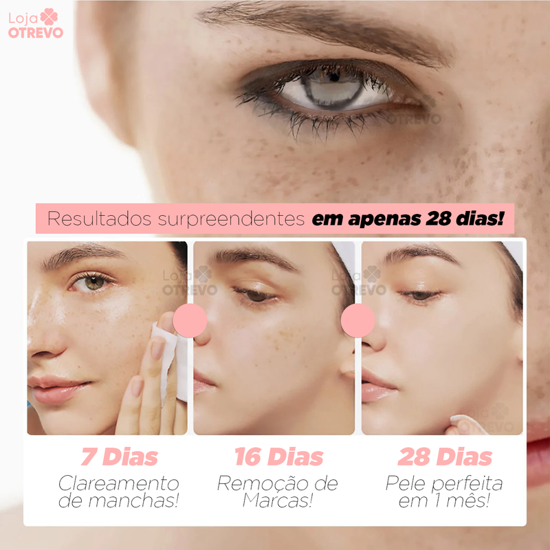 SpotCream® Creme Restaurador Facial 3 em 1 ( Remove Verruga, Manchas e Sinais)