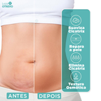 Spray Removedor Rápido de Cicatriz - ScarMax®