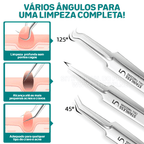 Pinças Super Skin - Kit Removedor de Cravos e Espinhas (3 Peças)