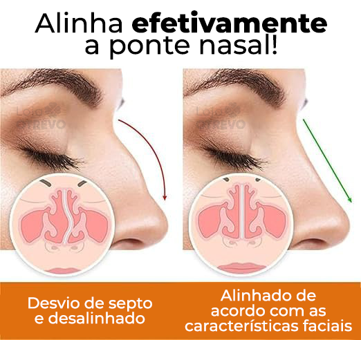 Sérum Definidor e Modelador de Nariz - DefRino®