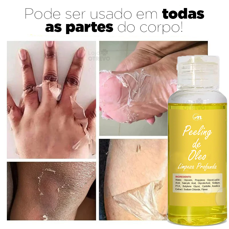 Óleo De Peeling (Clareador e Renovador de Pele) -  Yellow Oil®