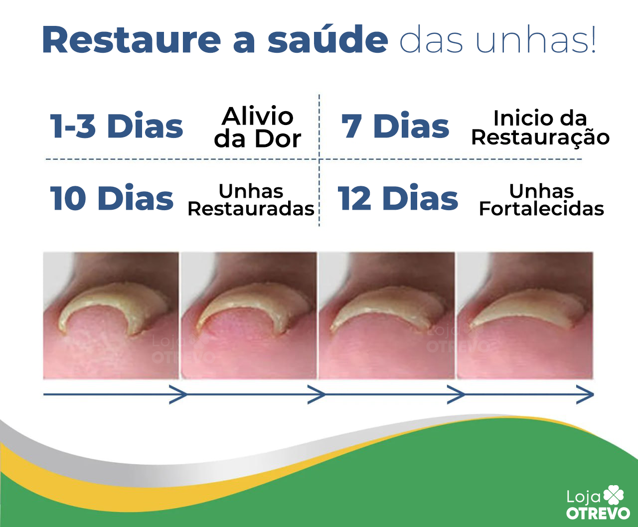 Adesivos Corretores de Unha - PatchNail® (REPARAÇÃO EM 7 DIAS)