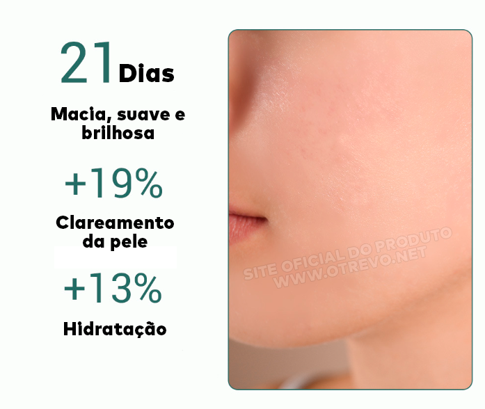 Sérum Removedor de Acne e Poros Dilatados - AcneLanbéna®