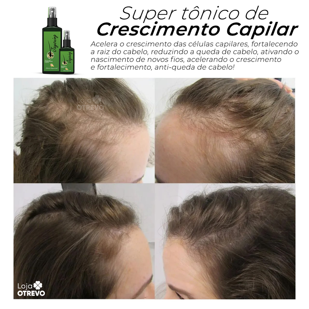 Super Tônico de Crescimento Rápido Capilar (Efeito Rapunzel) 2 em 1  - NutriHair®