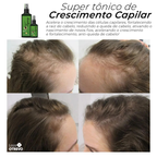 Super Tônico de Crescimento Rápido Capilar (Efeito Rapunzel) 2 em 1  - NutriHair®