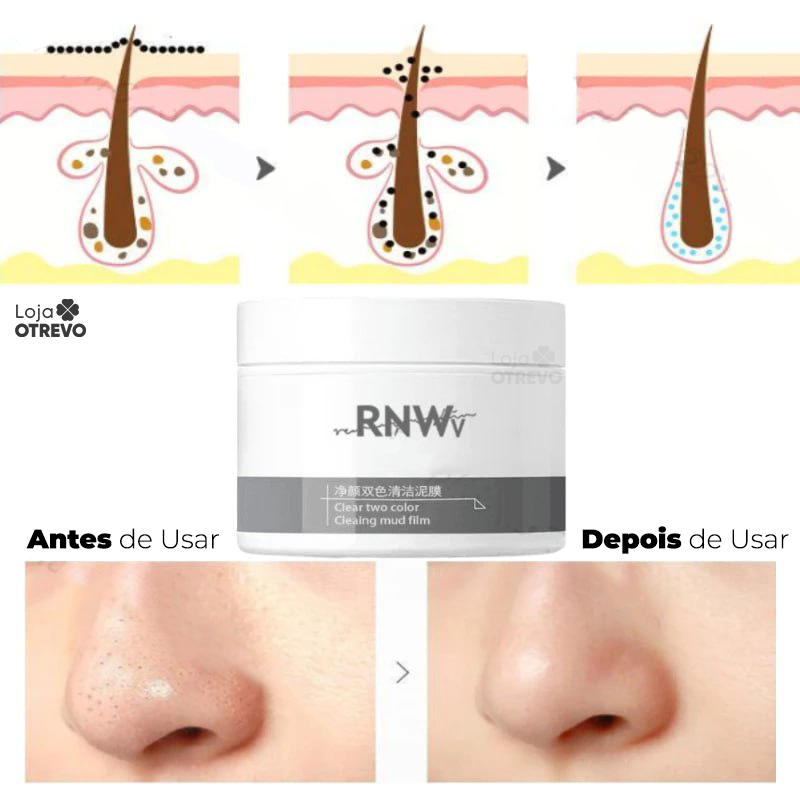 RNW - Máscara de Lama Vulcânica Removedora de Cravos e Acne 2 em 1 (LIMPEZA PROFUNDA)