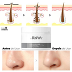 RNW - Máscara de Lama Vulcânica Removedora de Cravos e Acne 2 em 1 (LIMPEZA PROFUNDA)