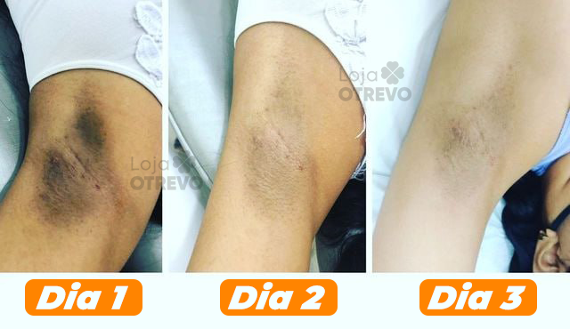 Sabonete Clareador a base de Limão e Enxofre - SoapWhite®