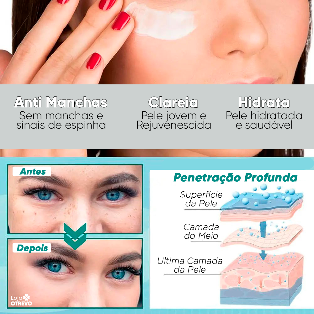 Creme Clareador de Manchas Escuras à Base de Leite - Milk Whitening® (Clareamento 100% Comprovado)