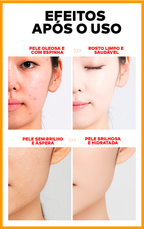 Gel Esfoliante e Clareador - ®OrangeBeauty (100% de Clareamento e Hidratação da Pele)