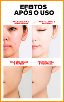 Gel Esfoliante e Clareador - ®OrangeBeauty (100% de Clareamento e Hidratação da Pele)