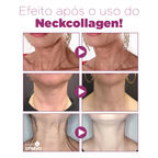 Creme Redutor de Papada e Rugas - NeckCollagen®