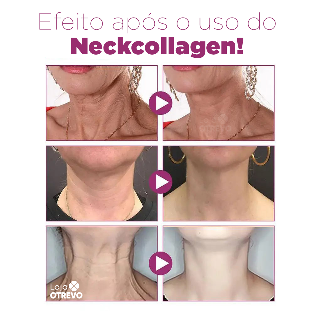 Creme Redutor de Papada e Rugas - NeckCollagen®