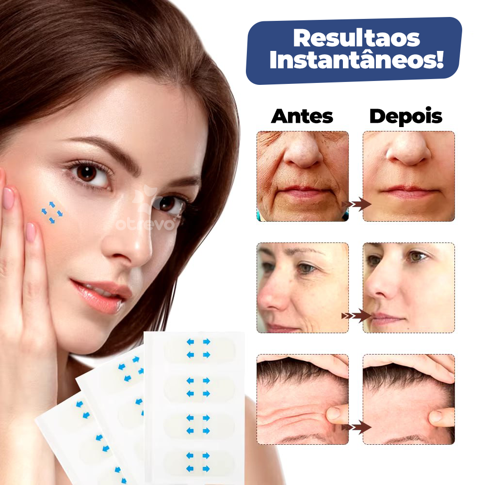 UpFace -  Esticador de Rosto e Redutor de Papada (EFEITO LIFITING INSTANTÂNEO)