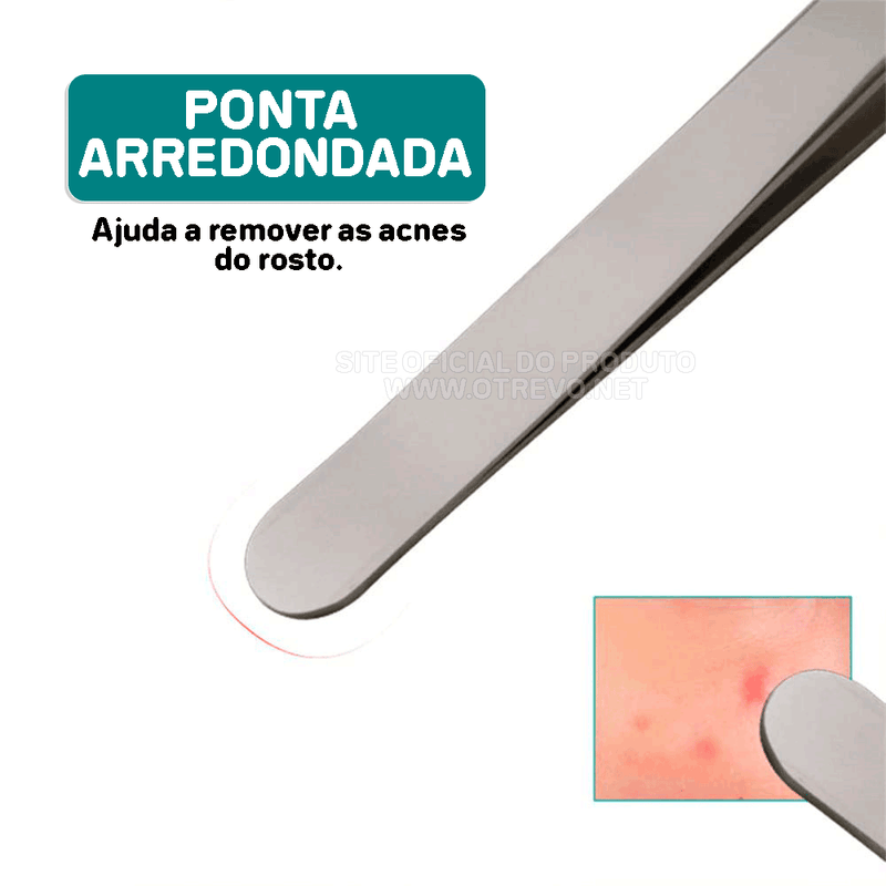 Pinças Super Skin - Kit Removedor de Cravos e Espinhas (3 Peças)