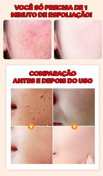 Gel Esfoliante e Clareador - ®OrangeBeauty (100% de Clareamento e Hidratação da Pele)