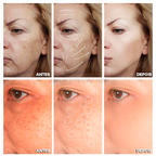 Super Serum Clareador Facial - ®GoldOrange