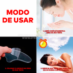 Adesivos de Silicone Antiestrias e Antirrugas Reutilizáveis - ®Youngirl (PELE 100% MAIS JOVEM)