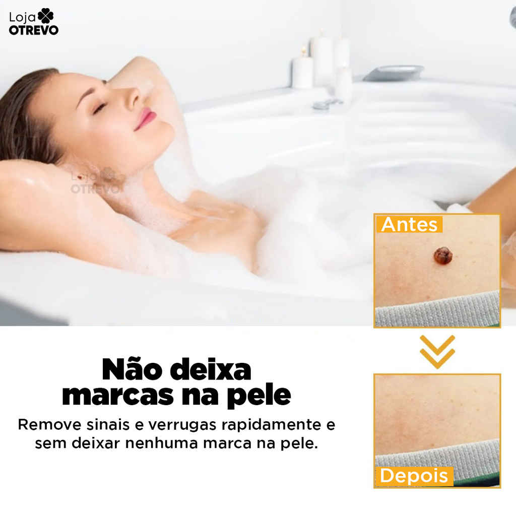 BeeTag - Spray Removedor Instantâneo de Verrugas e Sinais da Pele (EFEITO IMEDIATO)