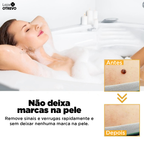 BeeTag - Spray Removedor Instantâneo de Verrugas e Sinais da Pele (EFEITO IMEDIATO)