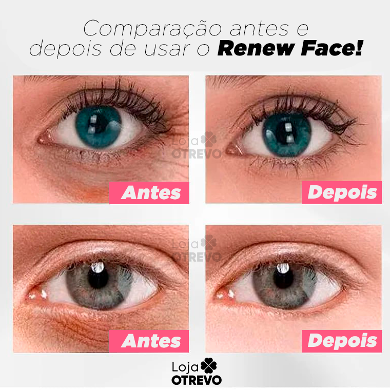 Renew Face CELYN® (Redutor de Olheira, Flacidez e Linha de Expressão)