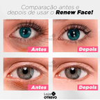 Renew Face CELYN® (Redutor de Olheira, Flacidez e Linha de Expressão)