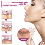 Creme Redutor de Papada e Rugas - NeckCollagen®