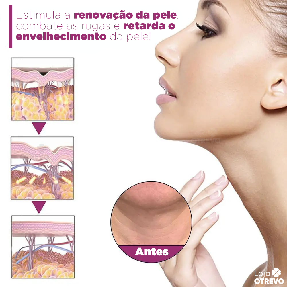 Creme Redutor de Papada e Rugas - NeckCollagen®