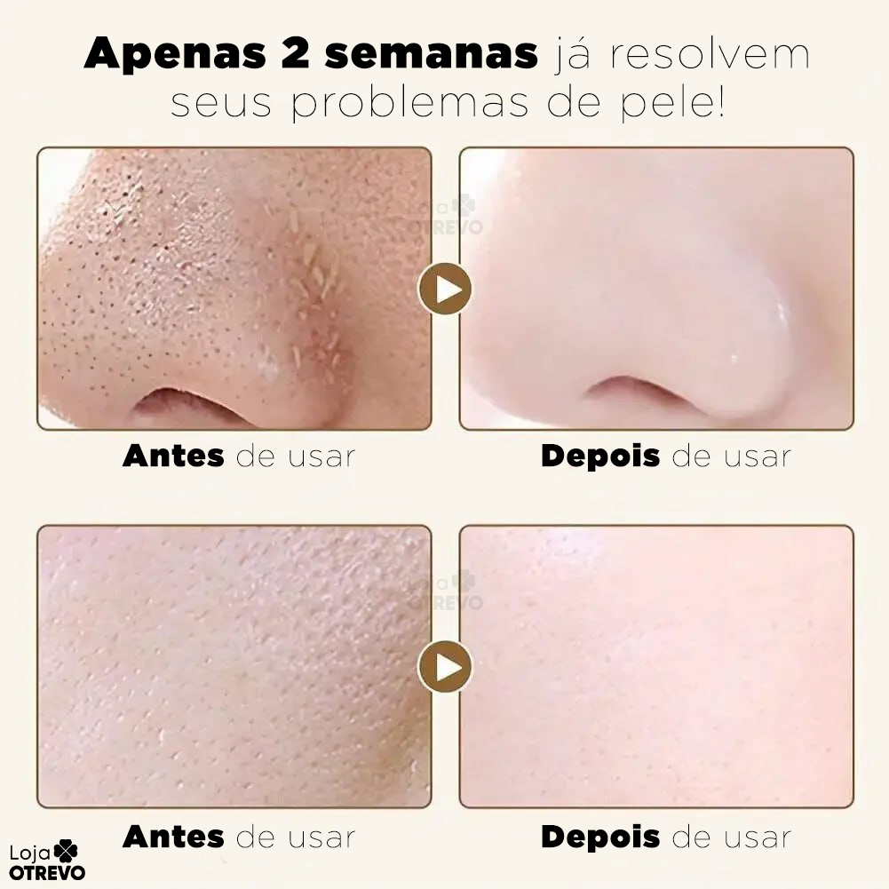 Gold Mask®  - Máscara Antienvelhecimento de Retinol Puro