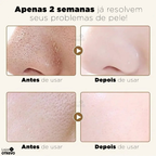 Gold Mask®  - Máscara Antienvelhecimento de Retinol Puro