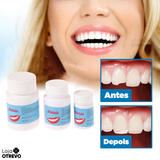 WhiteTeeth® -  Resina Temporária Reparadora de Dentes