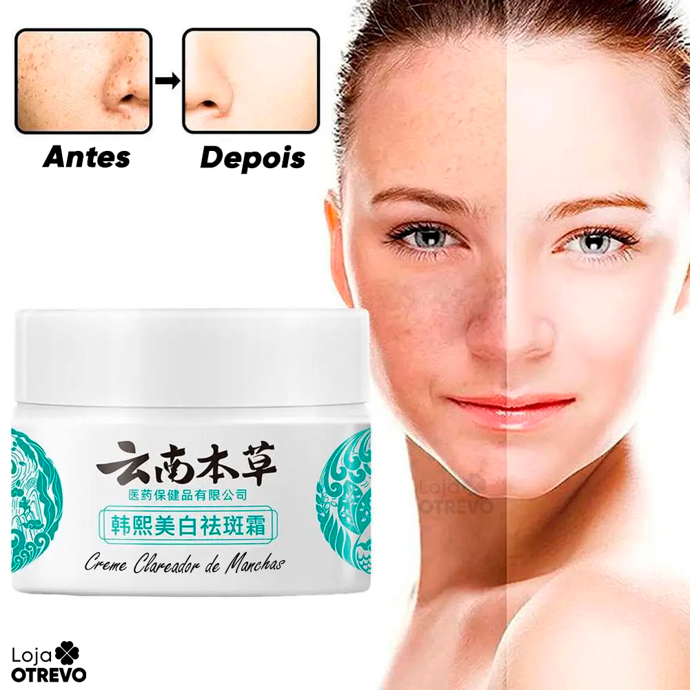 Creme Clareador de Manchas Escuras à Base de Leite - Milk Whitening® (Clareamento 100% Comprovado)